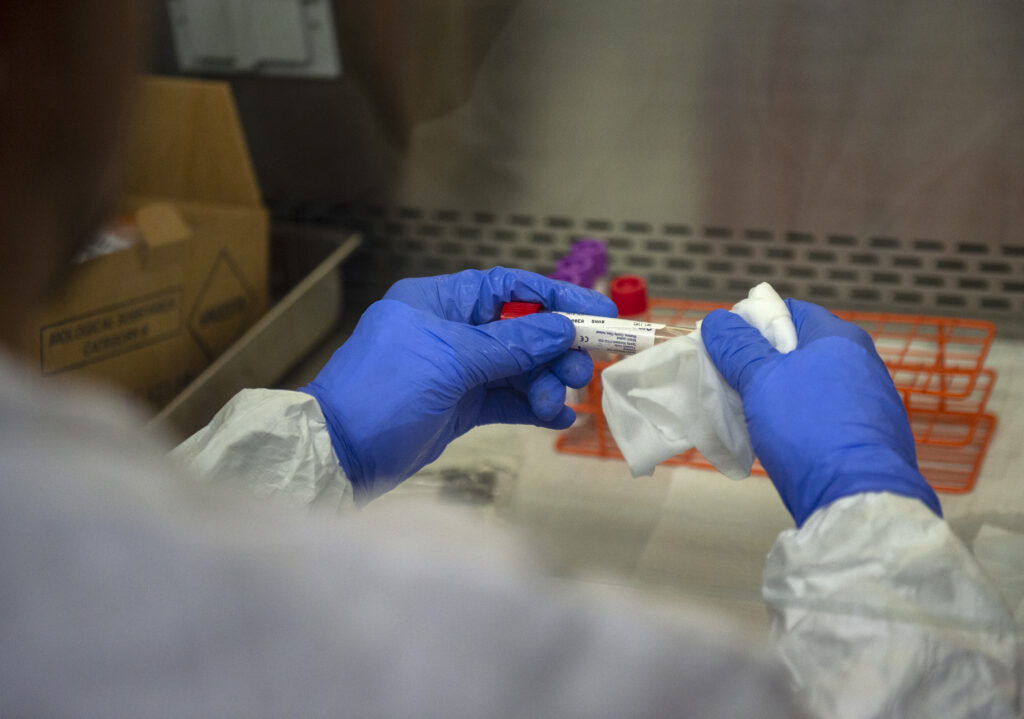 Public Health Lab Assistant Abraham Jimenez receives the specimen the Central Accessioning which is the in-take area to begin the polymerase chain reaction (PCR) test for COVID-19 on March 19, 2020. Jimenez decontaminates the outside of the container, and gives the sample an accession number to coincide with lavatory information system. ( Photo Credit: Los Aneles County )